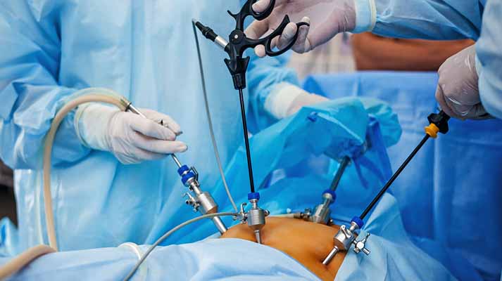 General Endo-Laparoscopic Surgery