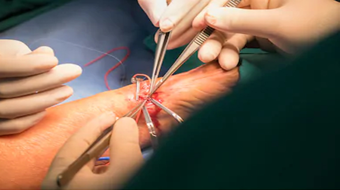 Vascular Surgery